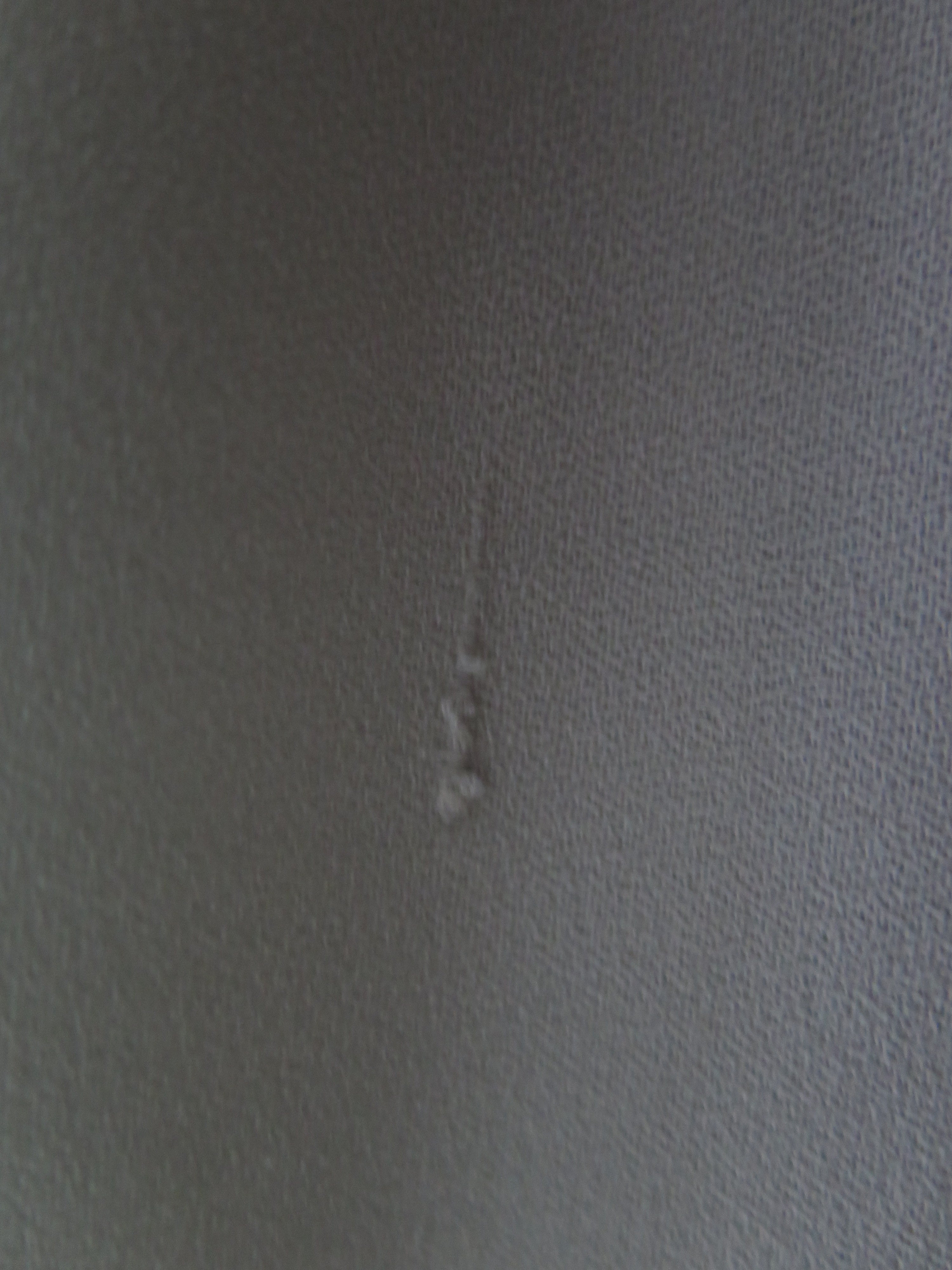 [DEFECT] Aloe Taraka S